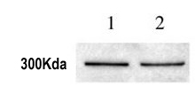 All lanes : Anti-ATR antibody - ChIP Grade (ab2905) at 1/1000 dilutionLane 1 : MCF10A breast epithelial cells, grown in normoxic conditions (20% O2). Cells were lysed with NP40.Lane 2 : MCF10A Breast Epithelial cells grown in hypoxic. conditions (5% O2). Cells were lysed with NP40.Lysates/proteins at 10 µg per lane.SecondaryGoat anti Rabbit (HRP) at 1/10000 dilutiondeveloped using the ECL techniquePerformed under reducing conditions.