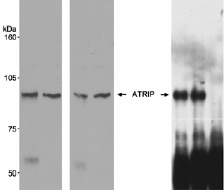 Detection of Human ATRIP using ab17962 by Western Blot (2 x left images) and Immunoprecipitation (right image).Samples: Whole cell lysate (100 µg for WB; 400 µg for IP) from HeLa (A & B) and 293-T (A) cells. Antibodies: Affinity purified rabbit anti-ATRIP antibody (ab17962) used at 1/500 and 1/15000 dilution for WB and 3 µg/0.4 mg lysate for IP. ATRIP was also immunoprecipitated using a control antibody generated to recombinant human ATRIP:Right image - lane 1 ab17962; lane 2 control antibody; lane 3 normal IgG.Immunoprecipitated ATRIP was detected using the antibody to the recombinant protein. Detection: Chemiluminescence with exposure times of 5 minutes (2 x left) and 45 seconds (right image).