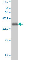 Western blot against tagged recombinant protein immunogen using ab56956 ATRIP antibody at 1ug/ml.