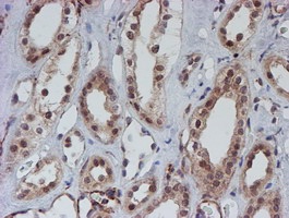 ab128529, at 1/150 dilution, staining ATRIP in paraffin-embedded Human kidney tissue by Immunohistochemistry.