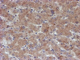 ab128529, at 1/150 dilution, staining ATRIP in paraffin-embedded Human liver tissue by Immunohistochemistry.