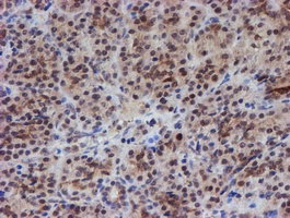 ab128529, at 1/150 dilution, staining ATRIP in paraffin-embedded Human pancreas tissue by Immunohistochemistry.