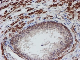 ab128529, at 1/150 dilution, staining ATRIP in paraffin-embedded Human prostate tissue by Immunohistochemistry.