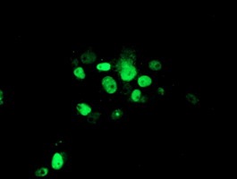 ab128529, at 1/100 dilution, staining ATRIP in COS7 cells transiently transfected with pCMV6-ENTRY ATRIP by Immunofluorescence.