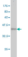 Western blot against tagged recombinant protein immunogen using ab55009 Atrophin 1 antibody at 1ug/ml. 