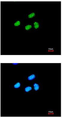 Immunofluorescence analysis of paraformaldehyde-fixed HeLa cells, using ab97508 at 1/200 dilution. Lower image is merged with DNA probe.