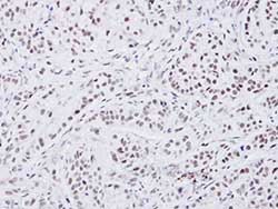 Immunohistochemical analysis of paraffin-embedded A549 xenograft, using ab97508 at 1/100 dilution.