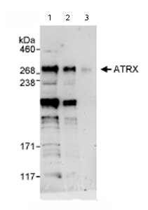 All lanes : Anti-ATRX antibody (ab72124) at 0.1 µg/mlLane 1 : Whole cell lysate from Hela cells at 50 µgLane 2 : Whole cell lysate from Hela cells at 15 µgLane 3 : Whole cell lysate from Hela cells at 5 µg
