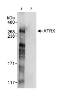 Immunoprecipitation/ Western Blot of ATRX. Lane 1: ab72124 at 3µg/mg whole cell lysate. Lane 2: Control IgG. ab72124 at 1µg/ml for WB. Whole cell lysate from Hela cells at 1mg for IP, 20% of IP loaded. Detection:Chemiluminescence with an exposure time of 10 seconds.