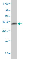 Western blot against tagged recombinant protein immunogen using ab54794 ATRX antibody at 1ug/ml.