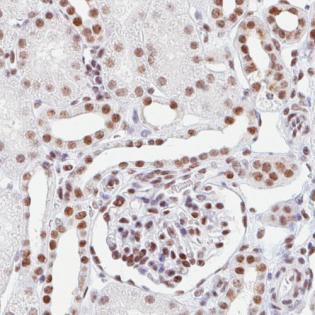 Immunohistochemical analysis of formalin-fixed, paraffin-embedded Human kidney tissue, labeling ATRX with ab188027 at 1/200 dilution.