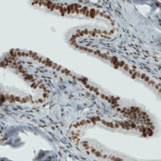 Immunohistochemical analysis of formalin-fixed, paraffin-embedded Human fallopian tube tissue, labeling ATRX with ab188027 at 1/200 dilution.
