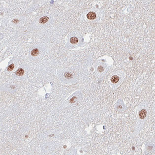 Immunohistochemical analysis of formalin-fixed, paraffin-embedded Human hippocampus tissue, labeling ATRX with ab188027 at 1/200 dilution.