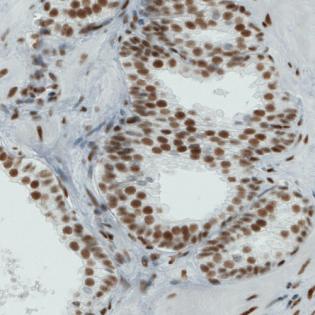 Immunohistochemical analysis of formalin-fixed, paraffin-embedded Human prostate tissue, labeling ATRX with ab188027 at 1/200 dilution.