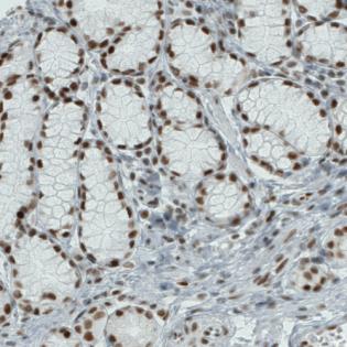 Immunohistochemical analysis of formalin-fixed, paraffin-embedded Human stomach tissue, labeling ATRX with ab188027 at 1/200 dilution.