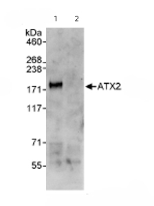 Immunoprecipitation/ Western Blot of ATX2. Lane 1: ab72263 at 3µg/mg whole cell lysate. Lane 2: Control IgG. ab72263 at 1µg/ml for WB. Whole cell lysate from Hela cells at 1mg for IP, 20% of IP loaded. Chemiluminescence with an exposure time of 30 seconds.