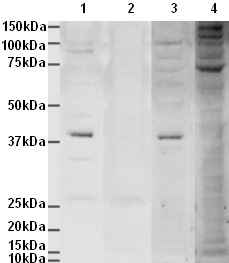 developed using the ECL techniquePerformed under reducing conditions.