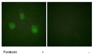 ab62702 at 1/500 - 1/1000 dilution staining Aurora B in HeLa cells, treated with Forskolin (40nM, 30mins) by Immunofluorescence.