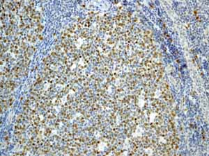 ab45145 showing positive staining in Normal tonsil tissue.