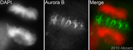 ab3609 (1/200) staining Aurora B in HeLa cells (green). Cells were fixed in paraformaldehyde, permeabilised with 0.5% Triton X-100/PBS and counterstained with DAPI in order to highlight the nucleus/ chromosomes (red). For further experimental details please refer to Abreview.See Abreview