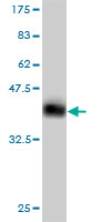 Western blot against tagged recombinant protein immunogen using ab56475 Axin 1 antibody at 1ug/ml.