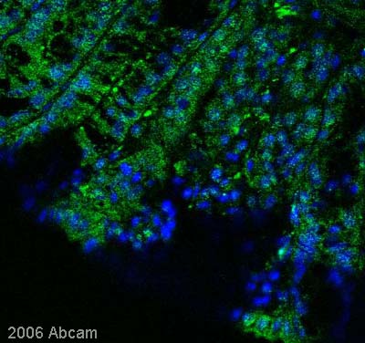 ab32197 staining Axin2 in mouse colon sections. Secondary antibody conjugated to Alexa-fluor ® 488 (please see Abreview for further details)See Abreview