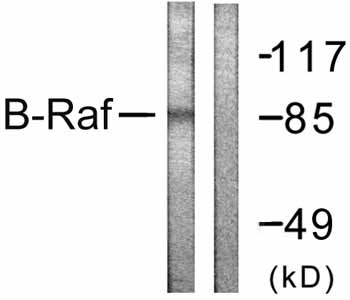 All lanes : Anti-B Raf antibody (ab59357) at 1/500 dilutionLane 1 : Extracts from K562 cells, minus immunising peptideLane 2 : Extracts from K562 cells, plus immunising peptideObserved band size : 85 kDa (why is the actual band size different from the predicted?)