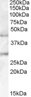 Anti-B3GNT1 antibody (ab77561) at 0.1 µg/ml + Human pancreas lysate in RIPA buffer at 35 µgdeveloped using the ECL technique