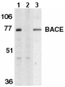 All lanes : Anti-BACE1 antibody (ab2077) at 1 µg/mlLane 1 : Human brain tissue lysate with absence of blocking peptideLane 2 : Human brain tissue lysate with BACE1 peptide (ab7883)Lane 3 : Mouse 3T3 cell lysateObserved band size : 70 kDa (why is the actual band size different from the predicted?)