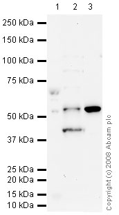All lanes : Anti-BACE1 antibody (ab63954) at 1 µg/mlLane 1 : Lung (Rat) Tissue LysateLane 2 : HepG2 (Human hepatocellular liver carcinoma cell line) Whole Cell LysateLane 3 : Kidney (Mouse) Tissue LysateLysates/proteins at 10 µg per lane.SecondaryGoat polyclonal to Rabbit IgG - H&L - Pre-Adsorbed (HRP) at 1/3000 dilutionPerformed under reducing conditions.