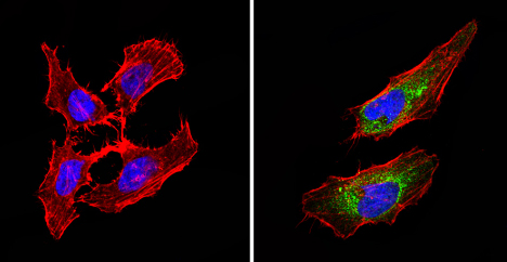 Immunocytochemistry/Immunofluorescence analysis of BACE2 (green) showing staining in the cytoplasm of Hela cells (right) compared to a negative control without primary antibody (left). Formalin-fixed cells were permeabilized with 0.1% Triton X-100 in TBS for 5-10 minutes and blocked with 3% BSA-PBS for 30 minutes at room temperature. Cells were incubated with a5671 in 3% BSA-PBS at a dilution of 1:50 and incubated overnight at 4 ºC in a humidified chamber. Cells were washed with PBST and incubated with a DyLight-conjugated secondary antibody in PBS at room temperature in the dark. F-actin (red) was stained with a flourescent red phalloidin and nuclei (blue) were stained with Hoechst or DAPI. Images were taken at a magnification of 60x.