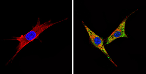 Immunocytochemistry/Immunofluorescence analysis of BACE2 (green) showing staining in the cytoplasm of NIH-3T3 cells (right) compared to a negative control without primary antibody (left). Formalin-fixed cells were permeabilized with 0.1% Triton X-100 in TBS for 5-10 minutes and blocked with 3% BSA-PBS for 30 minutes at room temperature. Cells were incubated with ab5671 in 3% BSA-PBS at a dilution of 1:50 and incubated overnight at 4 ºC in a humidified chamber. Cells were washed with PBST and incubated with a DyLight-conjugated secondary antibody in PBS at room temperature in the dark. F-actin (red) was stained with a flourescent red phalloidin and nuclei (blue) were stained with Hoechst or DAPI. Images were taken at a magnification of 60x.