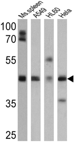 All lanes : Anti-BACE2 antibody (ab5671) at 1/500 dilutionLane 1 : Mouse spleen cell lysateLane 2 : A549 cell lysateLane 3 : HL60 cell lysateLane 4 : HeLa cell lysateLysates/proteins at 25 µg per lane.