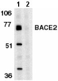 All lanes : Anti-BACE2 antibody (ab8024) at 1 µg/mlLane 1 : human heart tissue lysate with absence of blocking peptideLane 2 : human heart tissue lysate with presence of blocking peptide