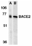 Western blot analysis of BACE2 in human (A) and mouse (B) heart tissue lysates with Ab8025 at 1 µg/ml.