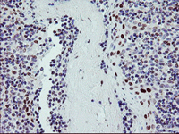 ab128486 at 1/150 dilution staining BACH1.3 in paraffin-embedded Human tonsil tissue by immunohistochemistry.