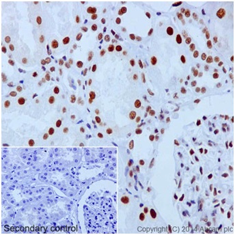 Immunohistochemical analysis of paraffin-embedded Human kidney tissue labeling Baf180 using ab196022 at 1/2000 dilution, followed by Goat Anti-Rabbit IgG H&L (HRP) (ab97051) at 1/500 dilution. Nuclear staining on Human kidney tissue is observed. Counter stained with Hematoxylin.Negative control: Used PBS instead of primary antibody, secondary antibody is Goat Anti-Rabbit IgG H&L (HRP) (ab97051) at 1/500 dilution.