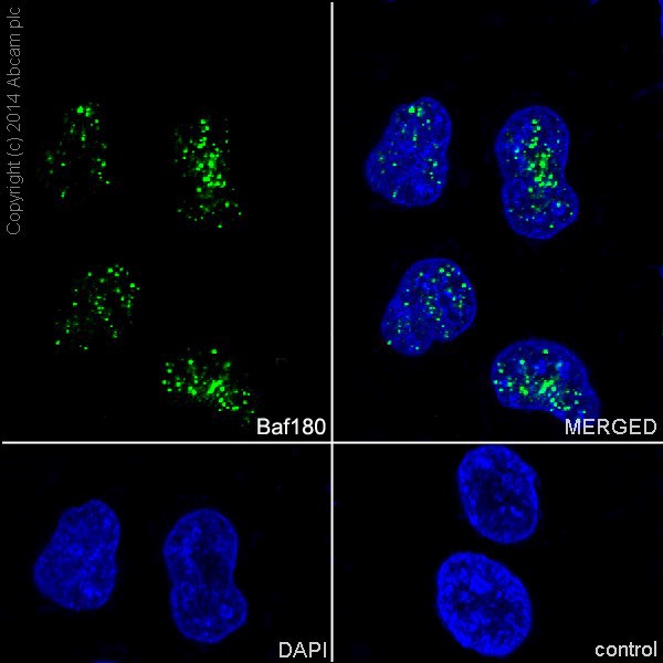 Immunofluorescent analysis of 4% paraformaldehyde-fixed, 0.1% Triton X-100 permeabilized HeLa (Human epithelial cells from cervix adenocarcinoma) cells labeling Baf180 with ab196022 at 1/100 dilution, followed by Goat anti-rabbit IgG (Alexa Fluor® 488) (ab150077) secondary antibody at 1/500 dilution (green). The nuclear counter stain is DAPI (blue).Nuclear staining on HeLa cell line is observed.-ve control - Goat anti-rabbit IgG (Alexa Fluor® 488) (ab150077) secondary antibody at 1/500 dilution. The nuclear counter stain is DAPI (blue).