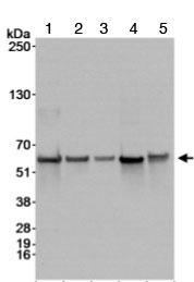 All lanes : Anti-BAF57/SMARCE1 antibody (ab70540) at 1/10000 dilutionLane 1 : Whole cell lysate from HeLa cells at 50 µgLane 2 : Whole cell lysate from HeLa cells at 15 µgLane 3 : Whole cell lysate from HeLa cells at 5 µgLane 4 : Whole cell lysate from 293T cells at 50 µgLane 5 : Whole cell lysate from NIH3T3 cells at 50 µgdeveloped using the ECL technique