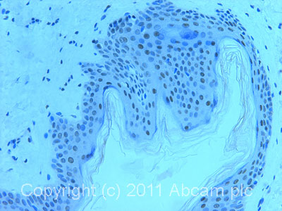 IHC image of ab70540 staining in normal human skin formalin fixed paraffin embedded tissue section, performed on a Leica BondTM system using the standard protocol F. The section was pre-treated using heat mediated antigen retrieval with sodium citrate buffer (pH6, epitope retrieval solution 1) for 20 mins. The section was then incubated with ab70540, 1µg/ml, for 15 mins at room temperature and detected using an HRP conjugated compact polymer system. DAB was used as the chromogen. The section was then counterstained with haematoxylin and mounted with DPX.For other IHC staining systems (automated and non-automated) customers should optimize variable parameters such as antigen retrieval conditions, primary antibody concentration and antibody incubation times.