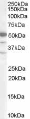 Anti-BAF57/SMARCE1 antibody (ab14764) at 0.2 µg/ml + Jurkat lysate at 35 µg