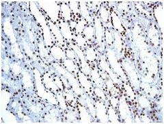 Immunohistochemical analysis of paraffin-embedded Human kidney tissue labelling BAF57/SMARCE1 with ab131328 at 1/100 dilution.