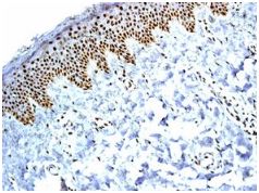 Immunohistochemical analysis of paraffin-embedded Human skin tissue labelling BAF57/SMARCE1 with ab131328 at 1/100 dilution.