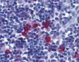 Immunohistochemistry (formalin-fixed paraffin-embedded) of BAFF Receptor in human tonsil tissue with ab5965 at 5 ug/ml.
