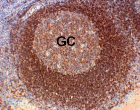 Immunohistochemistry staining of human tonsil with ab16232, showing intense staining of B cell follicles and weaker staining on GC. Magnification X200.