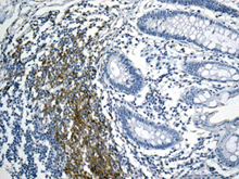 Immunohistochemical analysis of paraffin-embedded Human colon tissue labeling BAFF Receptor with ab168389 at 1/250 dilution.