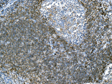 Immunohistochemical analysis of paraffin-embedded Human tonsil tissue labeling BAFF Receptor with ab168389 at 1/250 dilution.