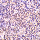 ab45411 at 2µg/ml staining Bag1-Aminoterminal end in human lymph nodes by IHC