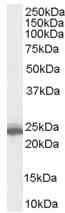 Anti-BAG2 antibody (ab752) at 0.3 µg/ml + Hela lysate (35ug protein in RIPA buffer).
