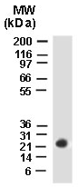 Anti-BAG2 antibody (ab47106) at 1/2000 dilution + HeLa cells